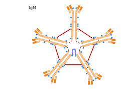 Waldenstrom macroglobulinema