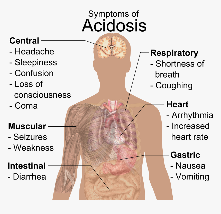 Acidosis RF