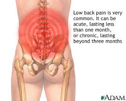 Acute pain RF