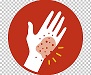 Cancer-malanoma