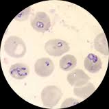 Babesia RF