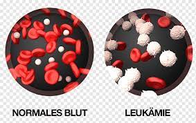 Cancer leukimia myeloid RF