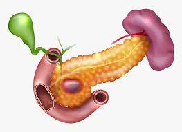 Cancer pancreatic RF