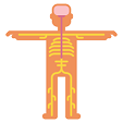 Cancer-nervous system neoplasma