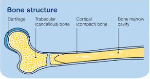 Cancer-osteosarcoma