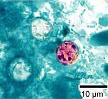 Cyclospora RF