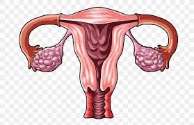 Cyst ovarian RF