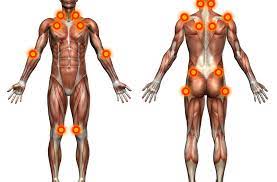 Fibromyalgia 3 RF