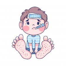 Foots and mouth syndrome RF