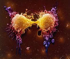 Cancer-trophoblastic neoplasms