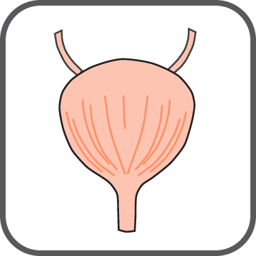 Cancer-urinary bladder neoplasma