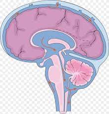 Central cord syndrome