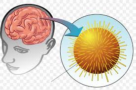 Encephalomyelitis