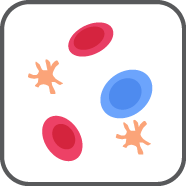 Erdheim Chester Disease