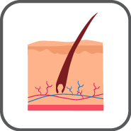 Erythema infectiosum