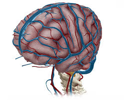 Hematoma subdural