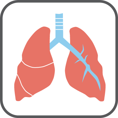 Hemoptysis