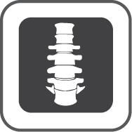 Intervertebral diskdisplacement