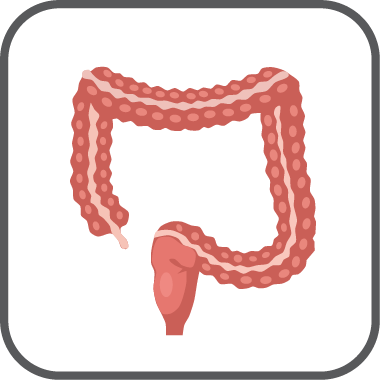 Intestinal neuronal dysplasia