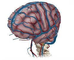 intracranial aneurysm