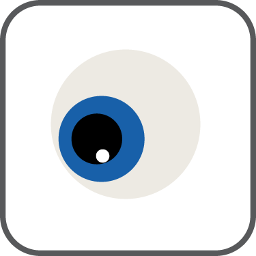 Keratoconus