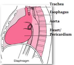 Mediastinal cyst