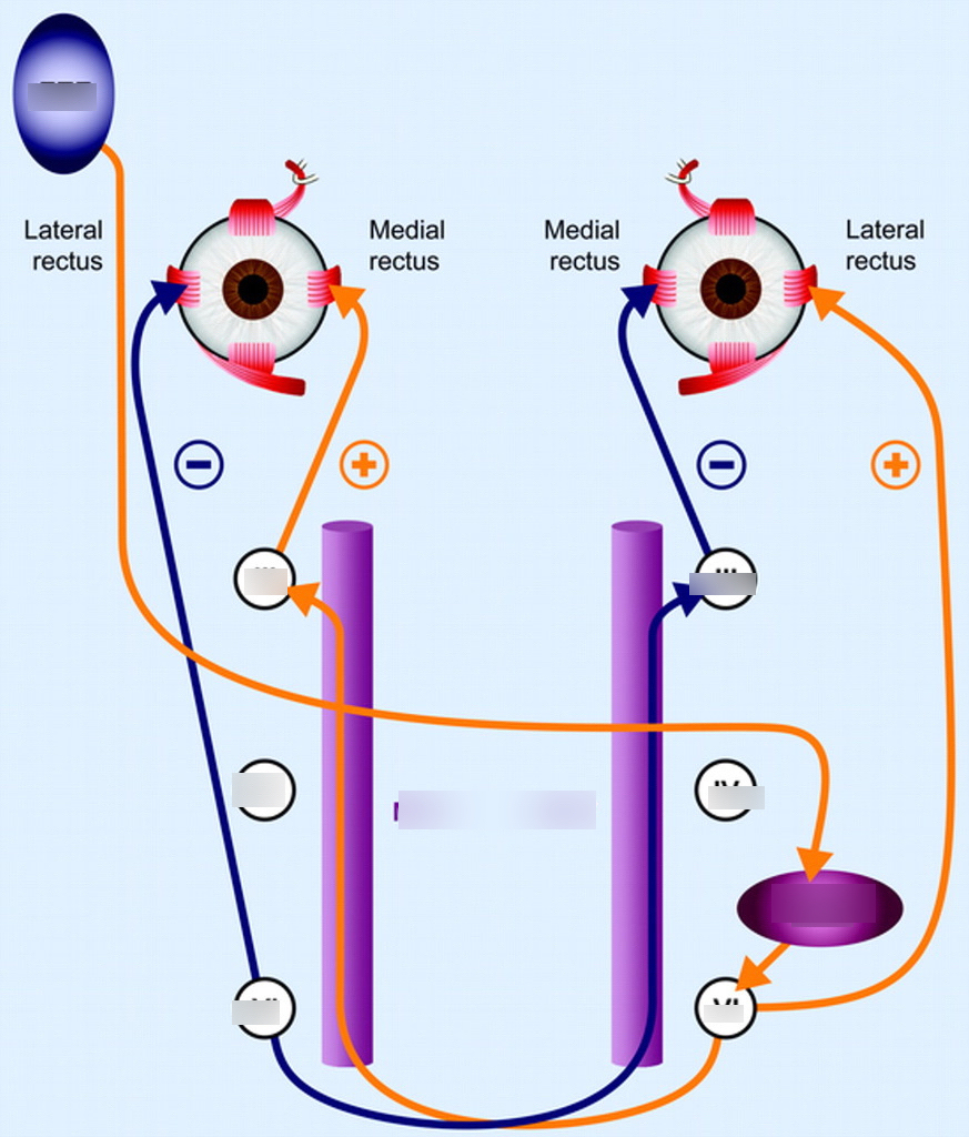 Ocular motility disorder