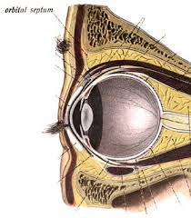 Orbital cellulitis