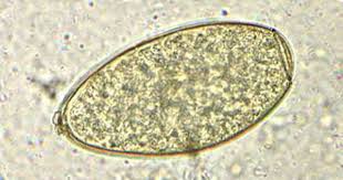 Parasites fasciola hepatica eggs