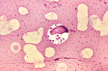 Parasites leishmania donovani