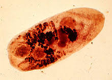 Parasites metagonimus yokogawi
