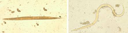 Parasites strongyloides 2