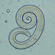 Parasites trichinella spiralis