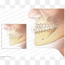 Prognathism