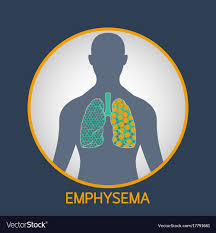 Pulmonary emphysema