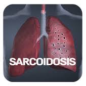 Sarcoidosis pulmonary