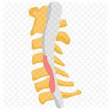 Spinal stenosis