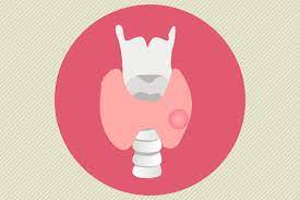 Thyroid nodule