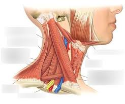 Torticollis